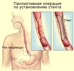 Глава 3. Хирургическая анатомия желудка собаки хирургический