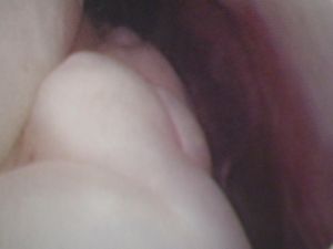 ПОСЛЕОПЕРАЦИОННЫЙ УХОД кошка ПОСЛЕОПЕРАЦИОННЫЙ УХОД кошка